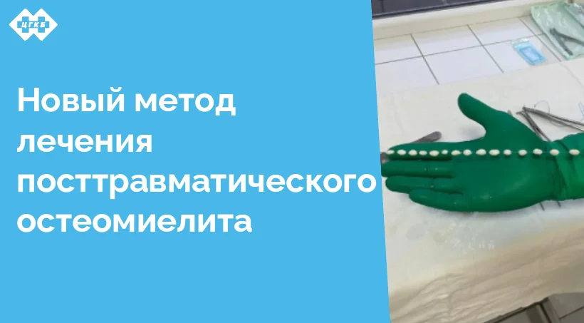 Хирурги Центральной городской клинической больницы (ЦГКБ) с успехом применяют антибактериальные спейсеры для лечения посттравматического остеомиелита