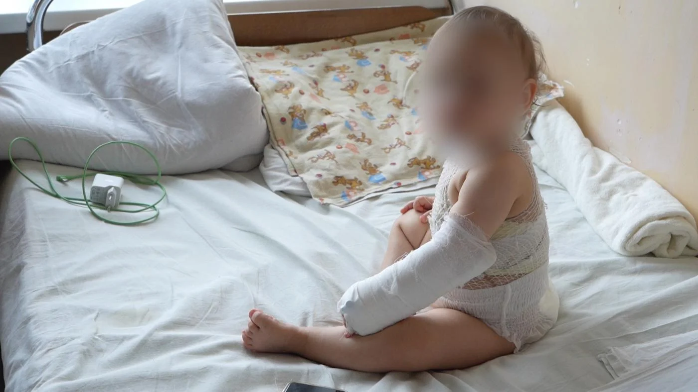 В новогодние праздники пациентами ожогового центра больницы на Летней стали семь жителей региона