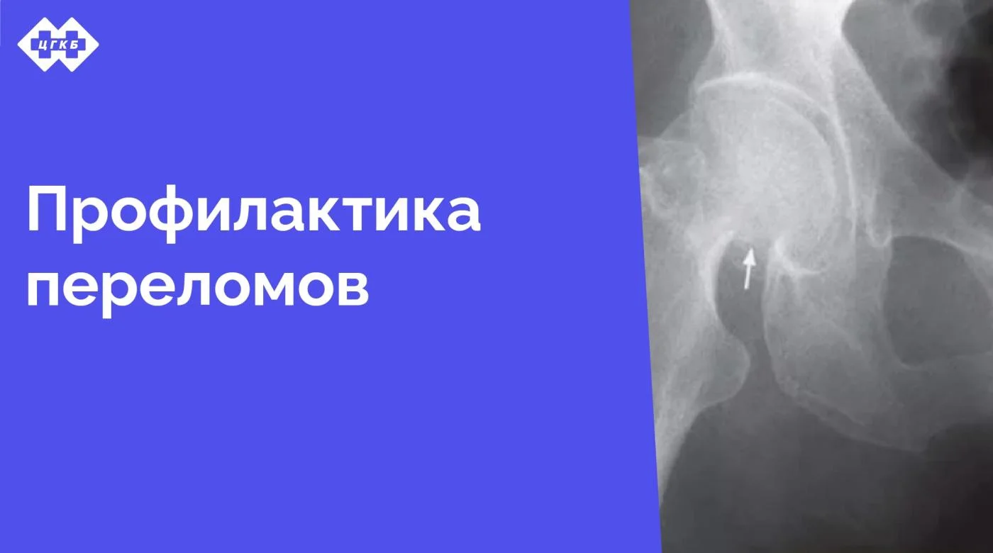 С 4 февраля 2025 года в поликлинике ЦГКБ начинает работу кабинет профилактики падений