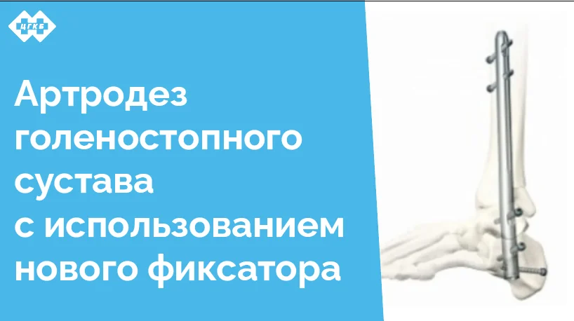 Отделение травматологии и ортопедии ЦГКБ, обладая высоким потенциалом и современным оборудованием, активно развивается, внедряя новые виды операций и методов лечения