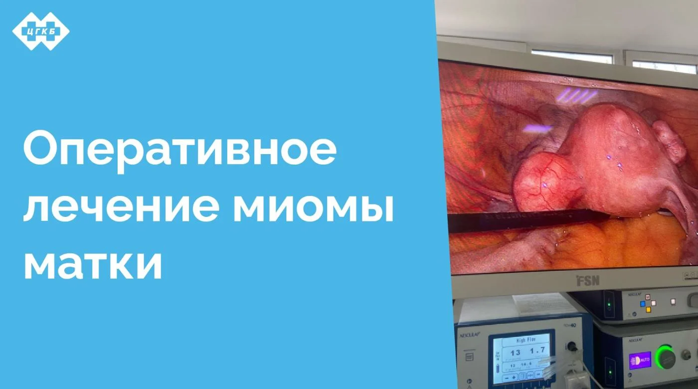 Во время планового посещения врача акушера-гинеколога у женщины 73 лет была диагностирована миома матки диаметром 5 см. Врачом женской консультации было выдано направление на плановое оперативное лечение в Центральную городскую клиническую больницу