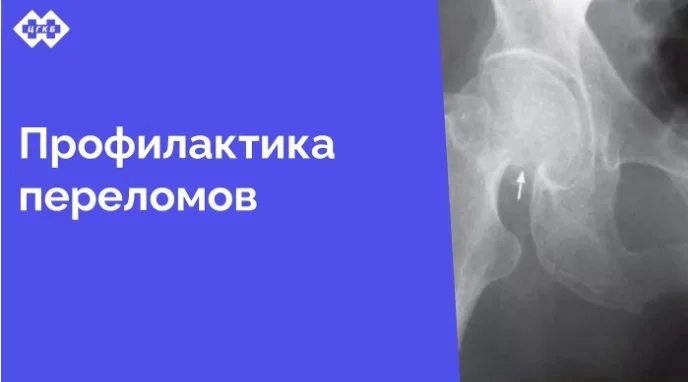 С 4 февраля 2025 года в поликлинике ЦГКБ начинает работу кабинет профилактики падений