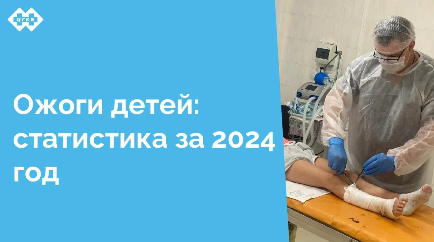 В 2024 году в приемном отделении ЦГКБ зарегистрированы 269 обращений по поводу ожогов у детей , из них 176 детей получили помощь амбулаторно, 93 госпитализированы в ожоговое отделение ЦГКБ