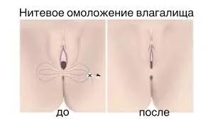 СХЕМА2.jpeg