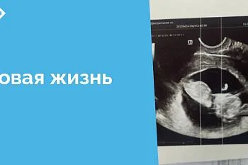 Случай этот – один из многих, когда профессионализм и чуткость медицинского персонала помогают женщине пересмотреть свое решение