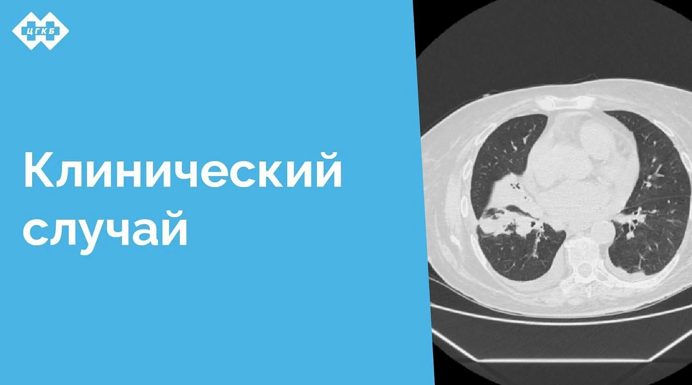 Эта история наглядно демонстрирует значимость мультидисциплинарного подхода в ведении пациентов со сложными заболеваниями