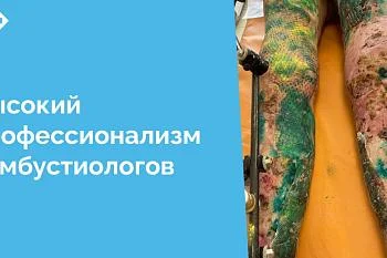 Врачи ожогового отделения Центральной городской клинической больницы в короткие сроки восстановили кожный покров пациенту с обширными глубокими ранами