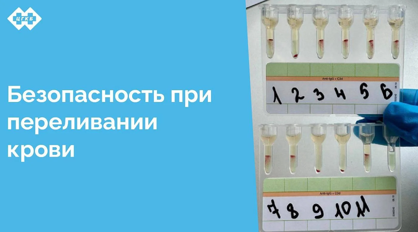 Иммуногематологические исследования, проводимые перед каждой гемотрансфузией, являются краеугольным камнем безопасности переливания крови