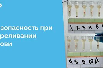 Иммуногематологические исследования, проводимые перед каждой гемотрансфузией, являются краеугольным камнем безопасности переливания крови