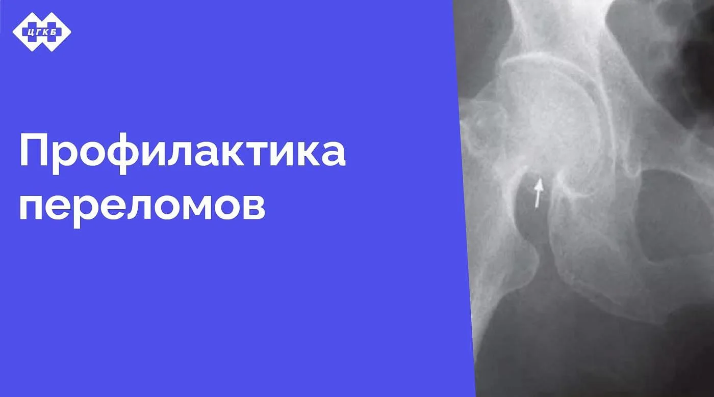 С 4 февраля 2025 года в поликлинике ЦГКБ начинает работу кабинет профилактики падений С 4 февраля 2025 года в поликлинике ЦГКБ начинает работу кабинет профилактики падений