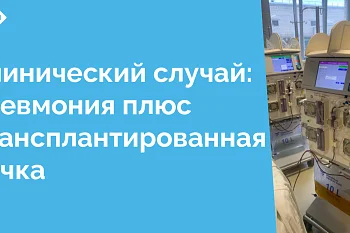 Этот случай демонстрирует важность мультидисциплинарного подхода и индивидуализации лечения у пациентов с сопутствующими заболеваниями и трансплантированными органами