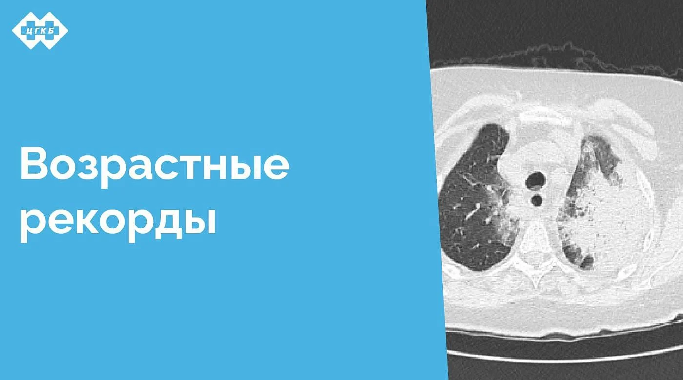 Из отделения пульмонологии ЦГКБ выписана пациентка 87 лет, которая провела 45 дней на ИВЛ в борьбе с дыхательной недостаточностью