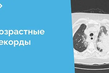 Из отделения пульмонологии ЦГКБ выписана пациентка 87 лет, которая провела 45 дней на ИВЛ в борьбе с дыхательной недостаточностью