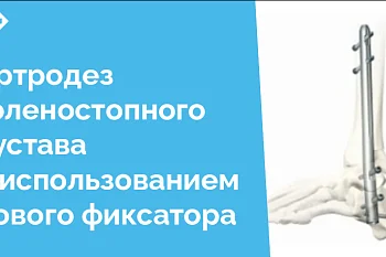 Отделение травматологии и ортопедии ЦГКБ, обладая высоким потенциалом и современным оборудованием, активно развивается, внедряя новые виды операций и методов лечения