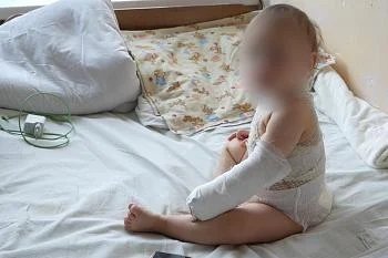 В новогодние праздники пациентами ожогового центра больницы на Летней стали семь жителей региона