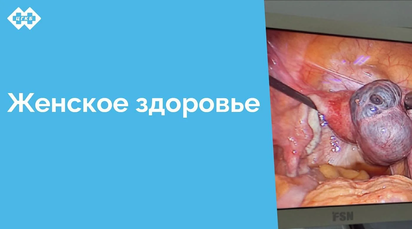 Сотрудники отделения гинекологии ЦГКБ успешно выполнили органосохраняющую операцию молодой женщине.