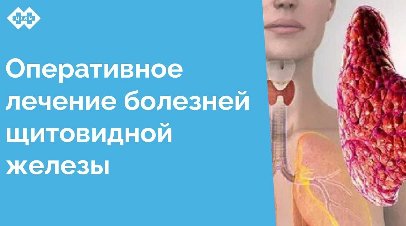 В ЦГКБ проводится полный спектр операций на щитовидной железе, охватывающих как доброкачественные, так и злокачественные патологии