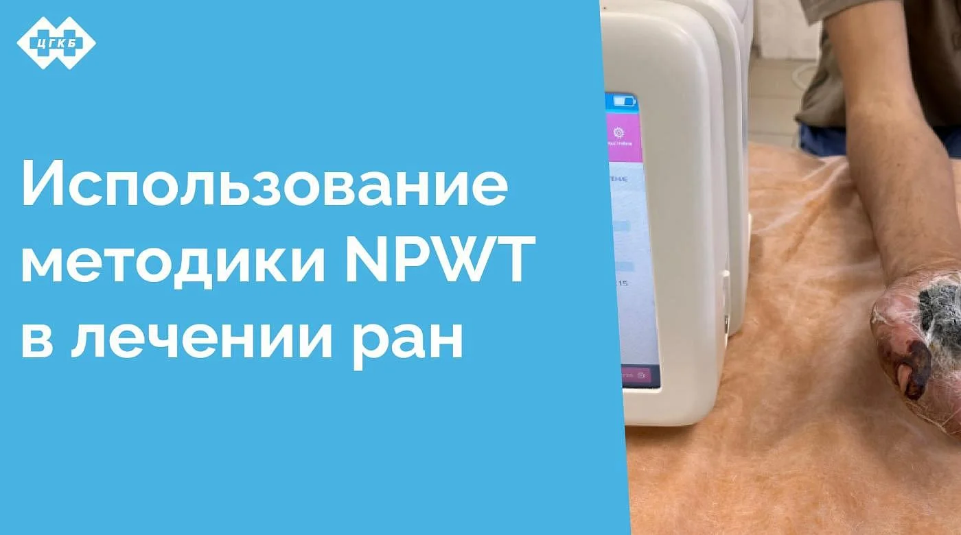 В хирургическом отделении № 4 ЦГКБ активно используются передовые технологии для лечения ран