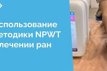 В хирургическом отделении № 4 ЦГКБ активно используются передовые технологии для лечения ран