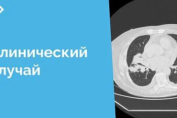 Эта история наглядно демонстрирует значимость мультидисциплинарного подхода в ведении пациентов со сложными заболеваниями