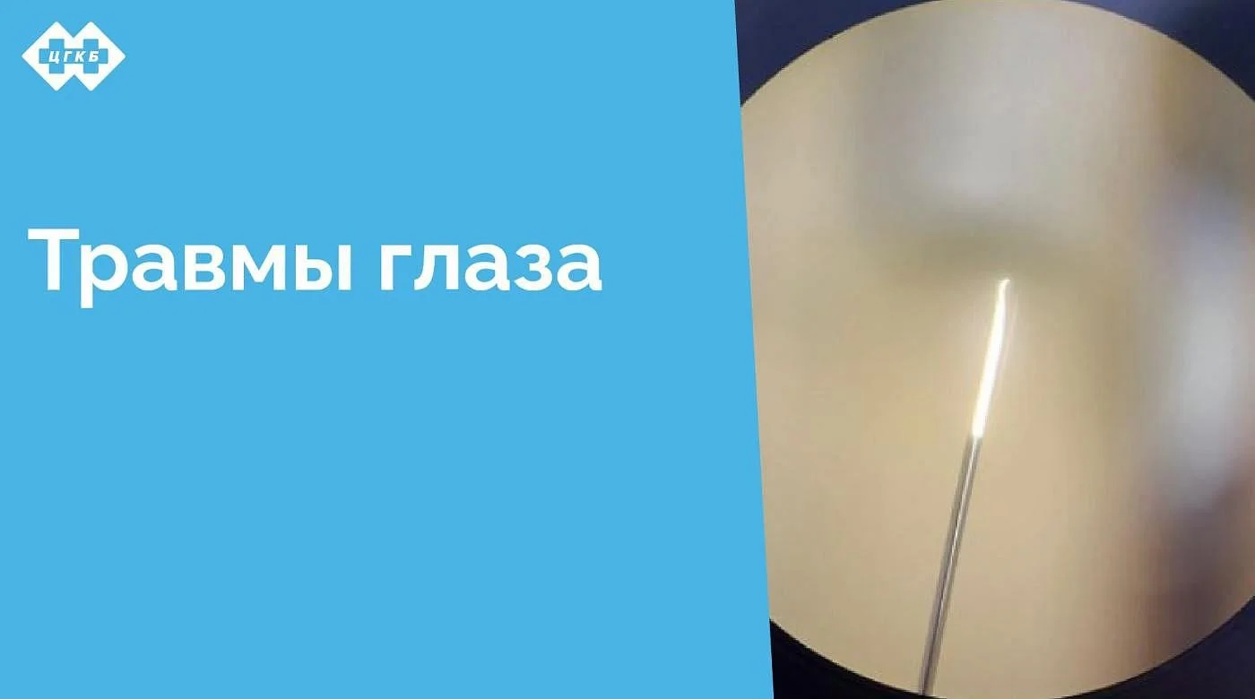 В ЦГКБ работает единственный в области офтальмологический травмпункт, в который ежедневно обращается от 50 до 90 пациентов