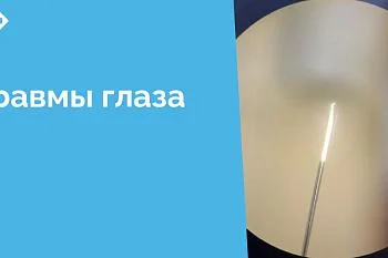 В ЦГКБ работает единственный в области офтальмологический травмпункт, в который ежедневно обращается от 50 до 90 пациентов