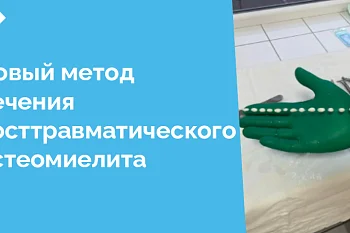 Хирурги Центральной городской клинической больницы (ЦГКБ) с успехом применяют антибактериальные спейсеры для лечения посттравматического остеомиелита