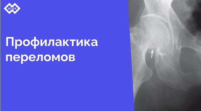 С 4 февраля 2025 года в поликлинике ЦГКБ начинает работу кабинет профилактики падений