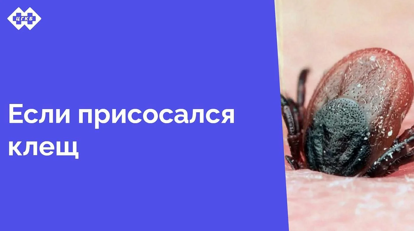 Теплая погода в январе способствовала раннему наступлению сезона активности клещей в Калининградской области. Уже в январе 2025 года зарегистрованы обращения пострадавших от укусов клещей Теплая погода в январе способствовала раннему наступлению сезона активности клещей в Калининградской области. Уже в январе 2025 года зарегистрованы обращения пострадавших от укусов клещей