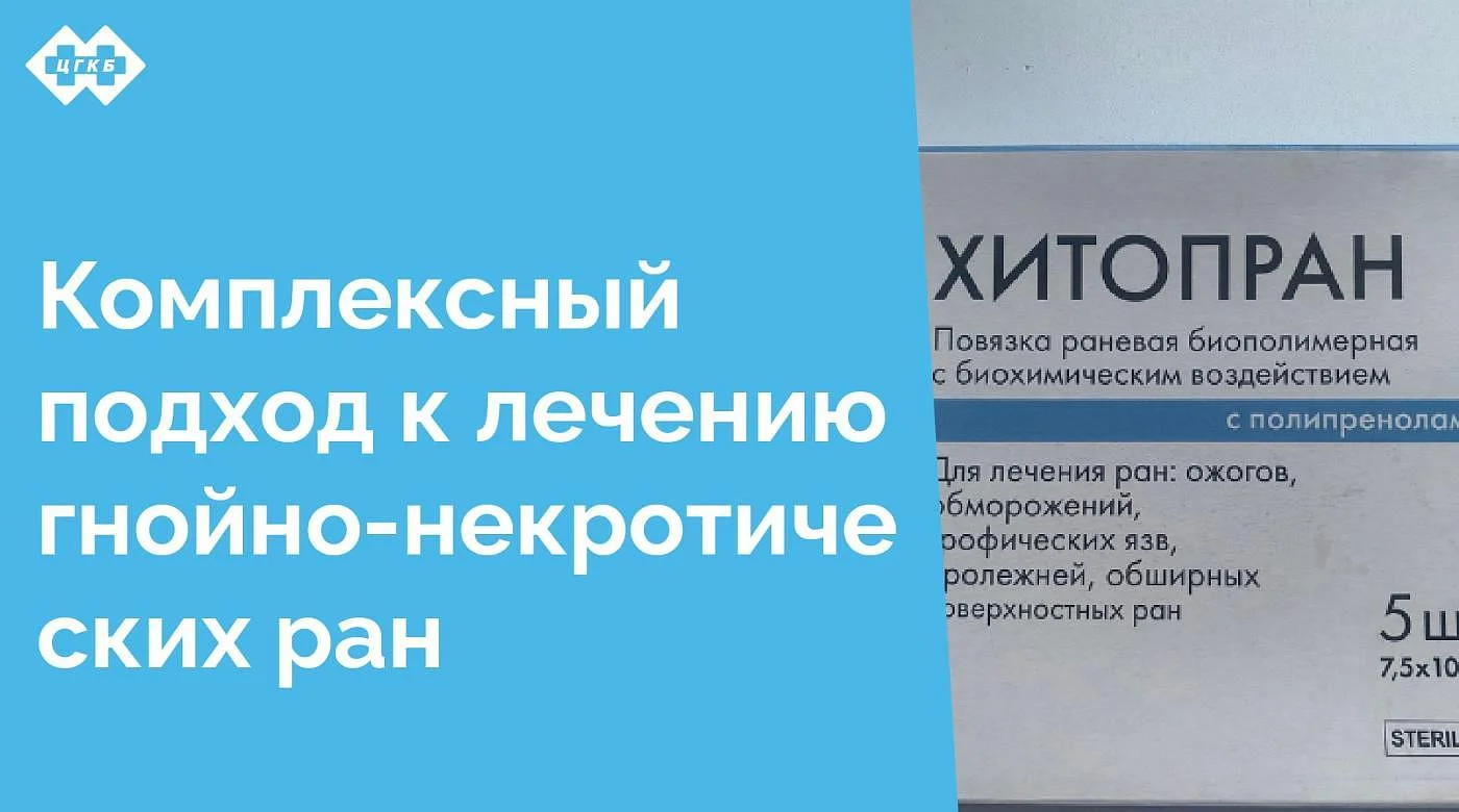 В последние месяцы в хирургических отделениях ЦГКБ увеличилось количество пациентов с гнойно-некротическими ранами. Применение комбинированных биологических методов местного лечения у этих пациентов позволяет в короткие сроки восстановить кожный покров