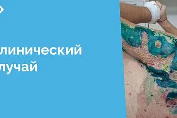 Лечение обширных постнекротических ран представляет собой сложную задачу, требующую комплексного подхода и индивидуальной тактики