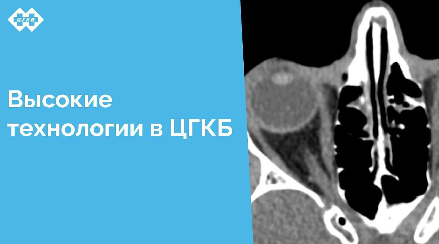17 апреля в офтальмологическом отделении Центральной городской клинической больницы проведена сложная высокотехнологичная операция
