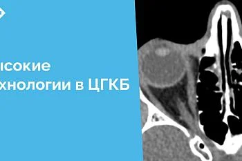 17 апреля в офтальмологическом отделении Центральной городской клинической больницы проведена сложная высокотехнологичная операция